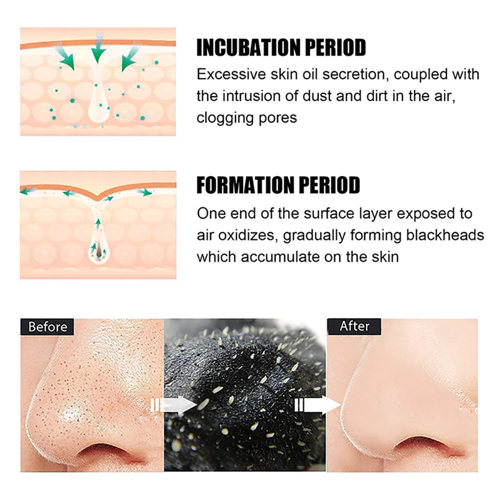10/20/50/100PCS Nose Blackhead - Charcoal Pore Strip 评论和价格