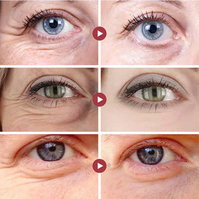 Wrinkle Remove Eyes Patches Fi - Collagen Sheet Mask 评论和价格