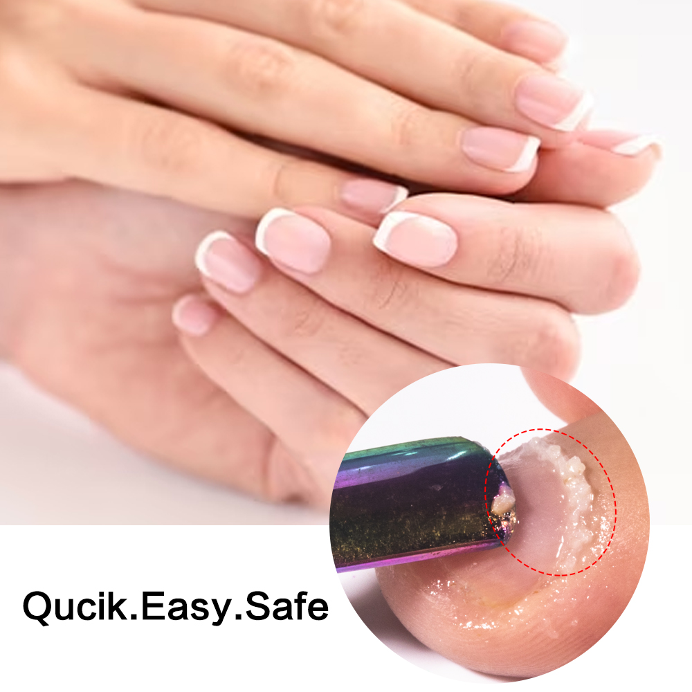 KODIES GEL Cuticle Remover 15M - Aha Bha Exfoliant 评论和价格